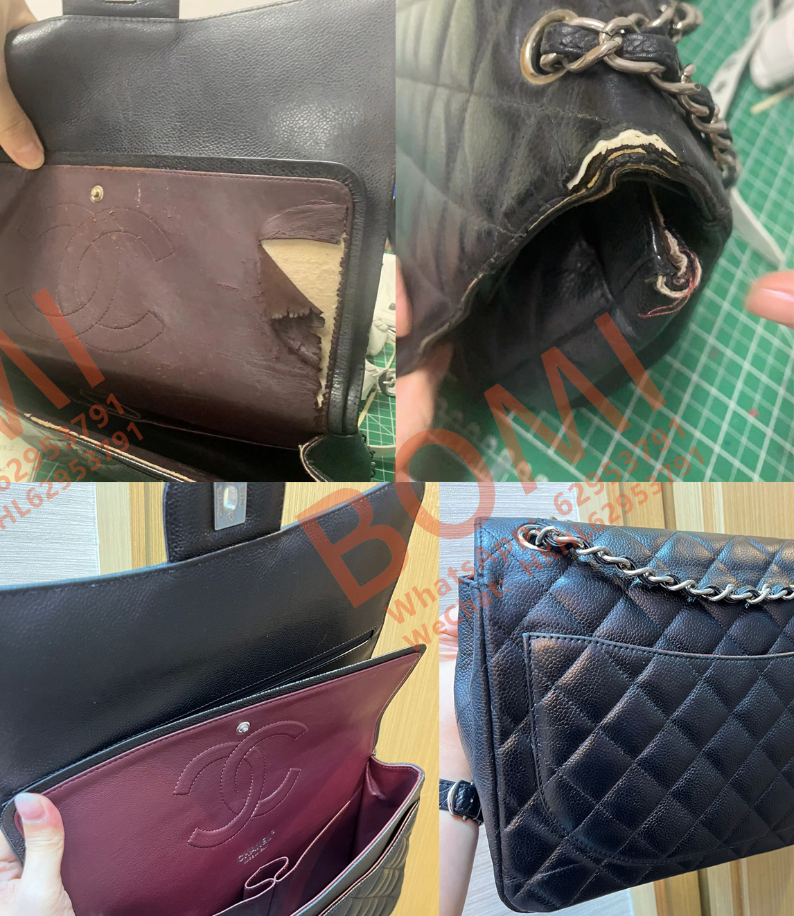 袋角磨穿修復案例